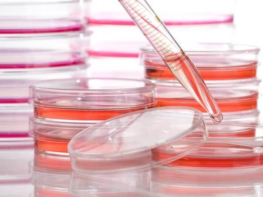 敷料类医疗器械生物相容性检测的重点项目有哪些？